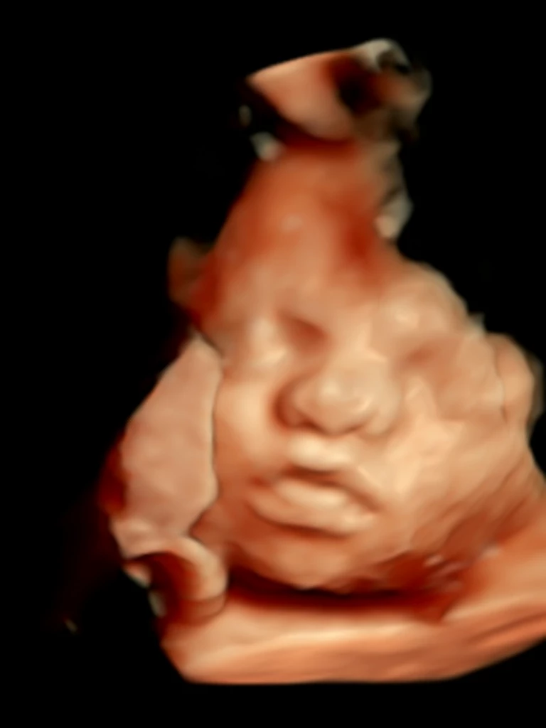 Rostinho de bebê sorrindo captado em ultrassom 4D na LOGUS